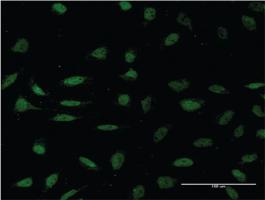 Anti-HMGXB4 Mouse Monoclonal Antibody [clone: 3C12]