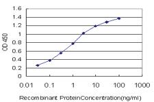 Anti-SCN11A Mouse Monoclonal Antibody [clone: 6E1]