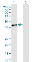 Anti-HSD11B2 Mouse Polyclonal Antibody