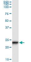 Anti-GUK1 Antibody Pair