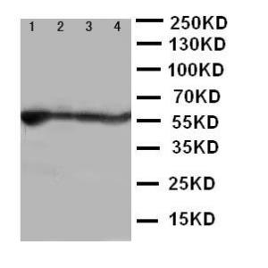 Anti-ALDH2 Rabbit Polyclonal Antibody