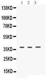 Anti-ERVW-1 Rabbit Polyclonal Antibody