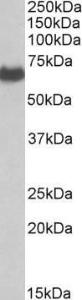 Anti-EHD2 Antibody (A83258) (0.1µg/ml) staining of Human Placenta lysate (35µg protein in RIPA buffer). Primary incubation was 1 hour. Detected by chemiluminescence.