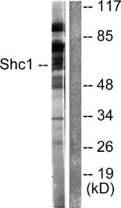 Western blot analysis of lysates from HeLa cells, treated with Calyculin A 50nM 15' using Anti-Shc Antibody The right hand lane represents a negative control, where the antibody is blocked by the immunising peptide