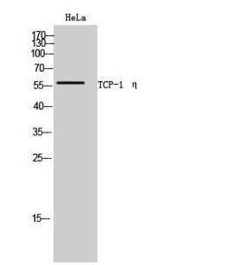 Western blot analysis of HeLa cells using Anti-CCT7 Antibody