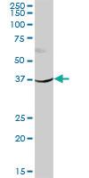 Anti-HSD11B2 Mouse Polyclonal Antibody