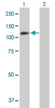 Anti-PPP1R13L Mouse Polyclonal Antibody