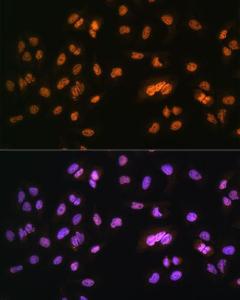 Immunofluorescence analysis of U2OS cells using Anti-NR2F2 Antibody (A8562) at a dilution of 1:100. DAPI was used to stain the cell nuclei (blue).