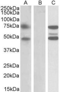 HEK293 lysate (10ug protein in RIPA buffer) overexpressing Human ASNSD1 with DYKDDDDK tag probed with Anti-ASNSD1 Antibody (A84873) (1 µg/ml) in Lane A and probed with anti-DYKDDDDK Tag (1/10000) in lane C