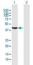 Anti-HSD11B2 Rabbit Polyclonal Antibody