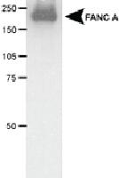 Anti-FANCA Rabbit Polyclonal Antibody