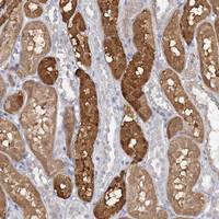 Anti-PNISR Rabbit Polyclonal Antibody