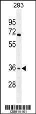 Anti-OR4F15 Rabbit Polyclonal Antibody (APC (Allophycocyanin))