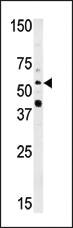 Anti-NMT2 Rabbit Polyclonal Antibody