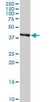 Anti-HSD11B2 Rabbit Polyclonal Antibody