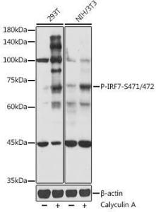 Western blot analysis of extracts of various cell lines, using Anti-IRF7 (phospho Ser471 + Ser472) Antibody (A306155) at 1:500 dilution 293T and NIH/3T3 cells were treated by Calyculin A (100 nM) at 37°C for 30 minutes after serum-starvation overnight