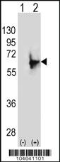 Anti-NMT2 Rabbit Polyclonal Antibody