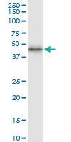 Anti-HSD11B2 Rabbit Polyclonal Antibody