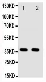 Anti-Annexin A10 Rabbit Polyclonal Antibody