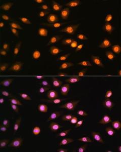 Immunofluorescence analysis of L929 cells using Anti-NR2F2 Antibody (A8562) at a dilution of 1:100. DAPI was used to stain the cell nuclei (blue).