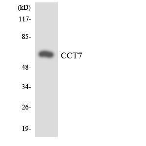 Western blot analysis of the lysates from HT 29 cells using Anti-CCT7 Antibody