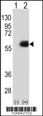 Anti-NMT2 Rabbit Polyclonal Antibody