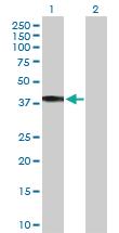 Anti-HSD11B2 Rabbit Polyclonal Antibody