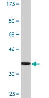 Anti-TECTA Mouse Monoclonal Antibody [clone: 2A5]