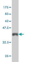 Anti-ATR Mouse Monoclonal Antibody [clone: 3F2]