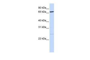 Anti-TLK1 Rabbit Polyclonal Antibody