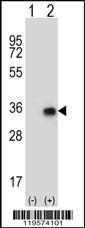 Anti-CNOT8 Rabbit Polyclonal Antibody (APC (Allophycocyanin))