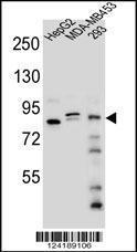 Anti-KANSL3 Rabbit Polyclonal Antibody (AP (Alkaline Phosphatase))