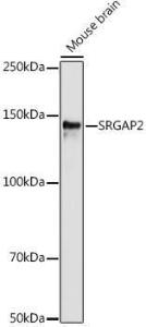 Western blot analysis of extracts of various cell lines, using Anti-srGAP2 Antibody (A306156) at 1:1,000 dilution