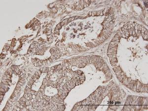 Anti-ERBB3 Mouse Monoclonal Antibody [clone: 2C7]