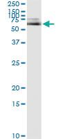 Anti-ALB Antibody Pair