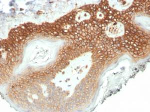 Immunohistochemical analysis of formalin-fixed, paraffin-embedded human colon using Anti-delta 1 Catenin Antibody [CTNND1/4501] at 2 µg/ml in PBS for 30 minutes at room temperature