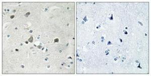 Immunohistochemical analysis of paraffin-embedded human brain using Anti-RPS4Y1 Antibody 1:100 (4°C overnight). The right hand panel represents a negative control, where the antibody was pre-incubated with the immunising peptide.