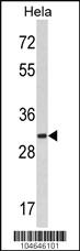 Anti-MARCKS Rabbit Polyclonal Antibody