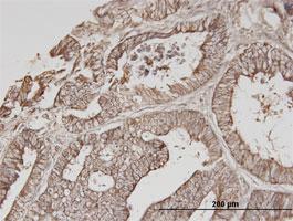 Anti-ERBB3 Mouse Monoclonal Antibody [clone: 2C7]