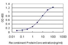 Anti-BSCL2 Mouse Monoclonal Antibody [clone: 1G4]