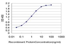 Anti-UPK1B Mouse Monoclonal Antibody [clone: 1E1]