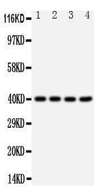 Anti-CXCR1 Rabbit Polyclonal Antibody