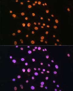 Immunofluorescence analysis of C6 cells using Anti-NR2F2 Antibody (A8562) at a dilution of 1:100. DAPI was used to stain the cell nuclei (blue).