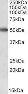 Anti-CYP2E1 Antibody (A84875) (0.05 µg/ml) staining of Human Liver lysate (35 µg protein in RIPA buffer). Primary incubation was 1 hour. Detected by chemiluminescence