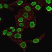 Immunofluorescent analysis of HeLa cells stained with Anti-Histone H1 Antibody [1415-1] (CF&#174; 488) (Green). Phalloidin is used to label the membranes