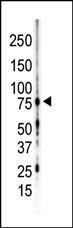 Anti-PRKCG Rabbit Polyclonal Antibody