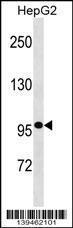 Anti-GANC Rabbit Polyclonal Antibody (Biotin)