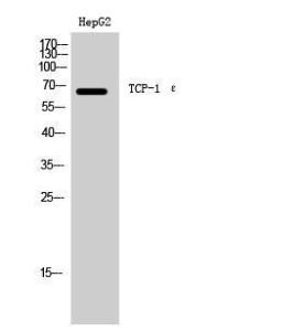 Western blot analysis of HepG2 cells using Anti-CCT5 Antibody