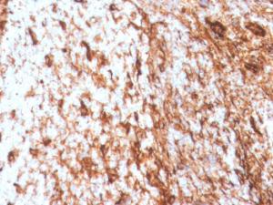 Antibody anti-SERBP1 SERBP13496 100 µg