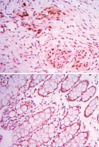 Anti-KDM4A Mouse Monoclonal Antibody [clone: 5H1]